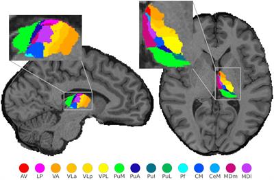 Functional mapping of sensorimotor activation in the human thalamus at 9.4 Tesla